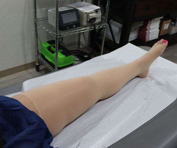 compression stocking